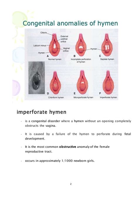 imperforate hymen|Imperforate Hymen: Symptoms, Outlook, Treatment, and More